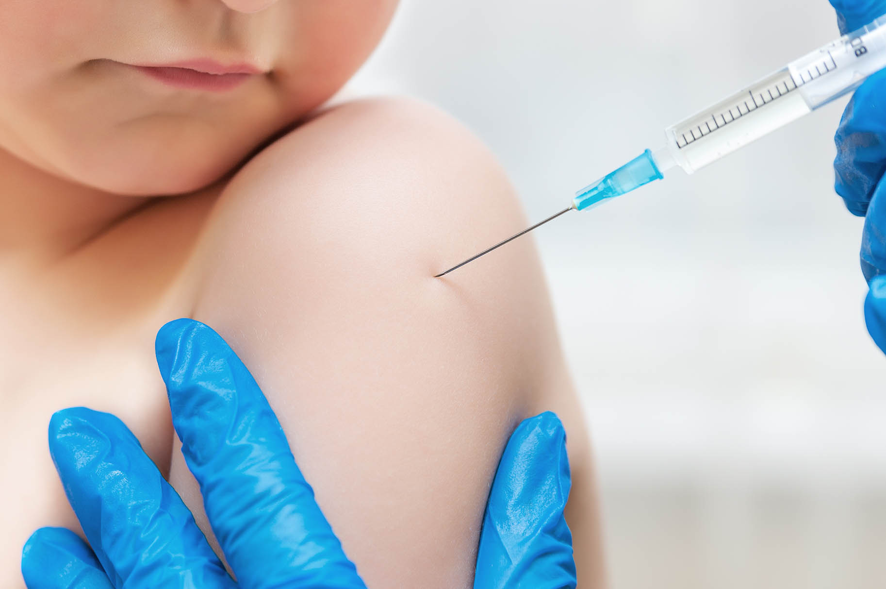 primo piano della spalla di un bambino durante la vaccinazione