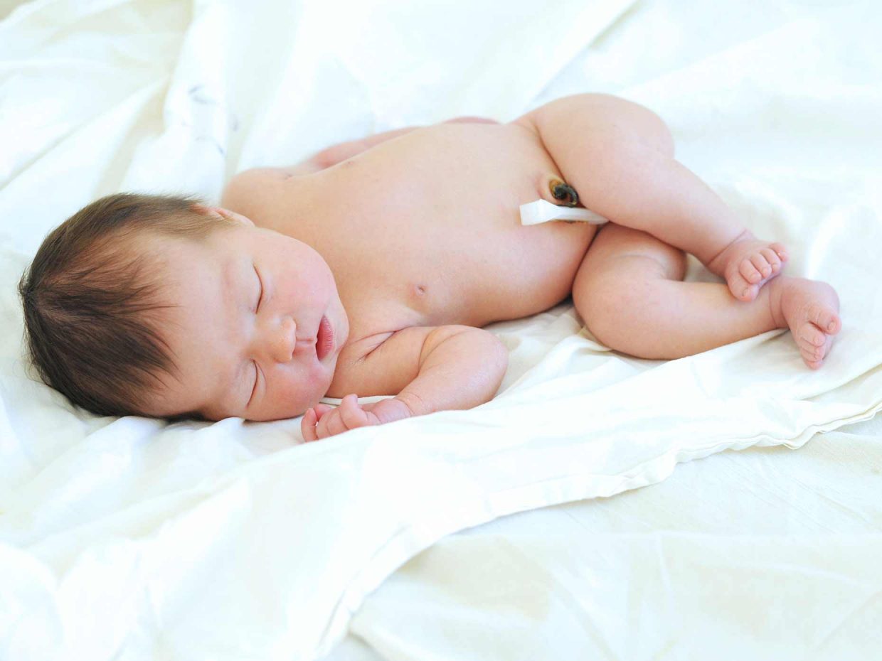Ombelico neonato: pulizia, cura , caduta, infezioni del moncone