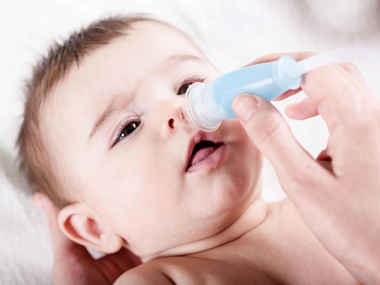 pulizia del naso di un bambino piccolo tramite aspiratore nasale a bocca