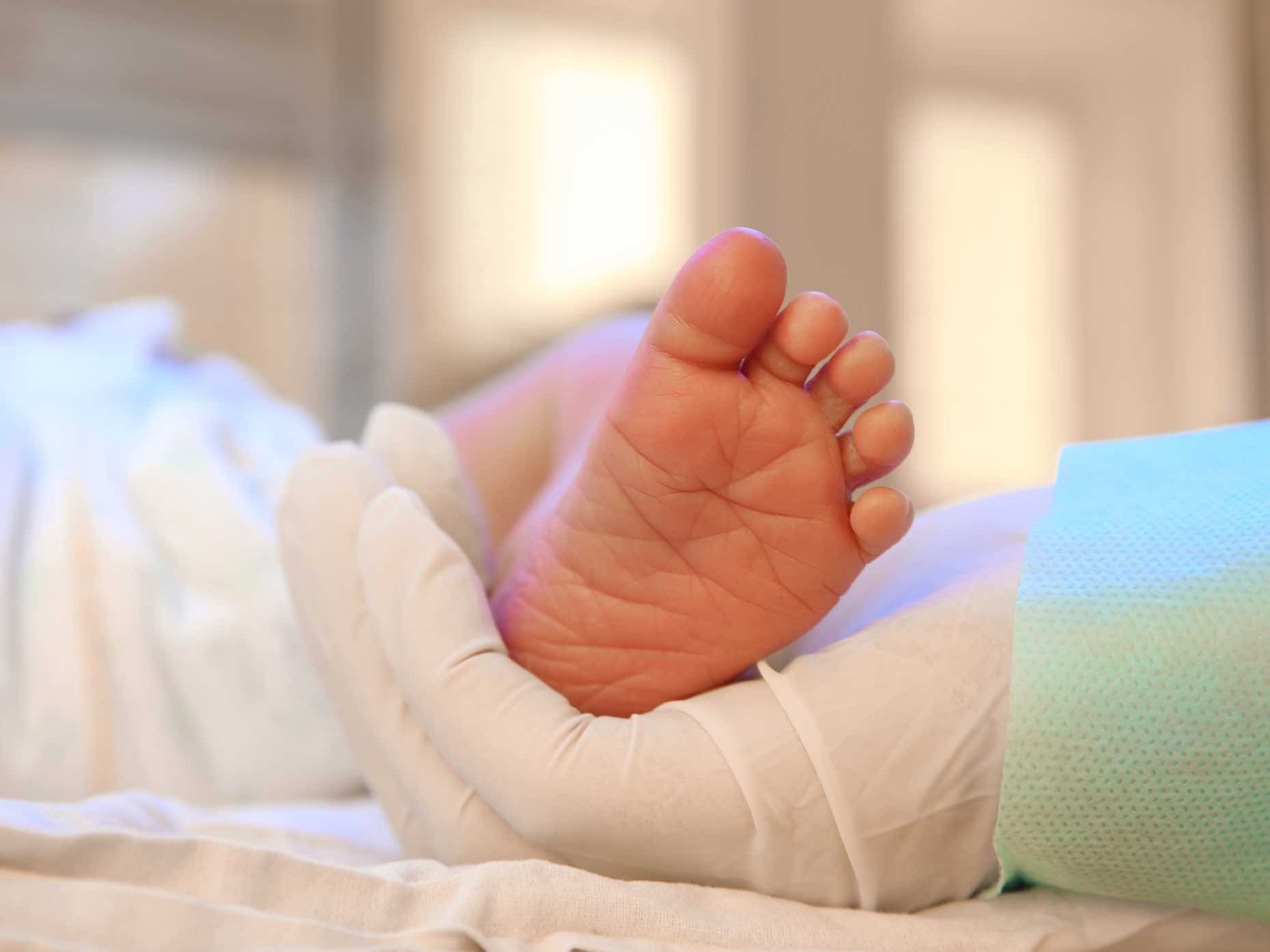 Ipotiroidismo Congenito E Acquisito Nei Bambini Sintomi Diagnosi E 